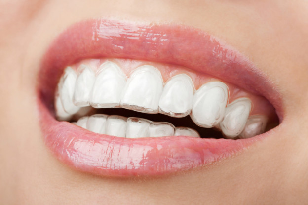 Orthodontic Manchester Treatment - How Are Teeth Moved?