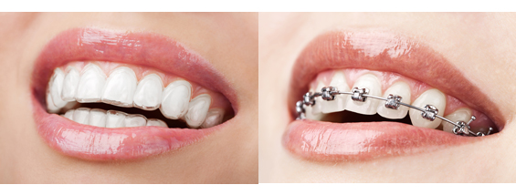 Adult Orthodontics Manchester – Just What Are Your Options
