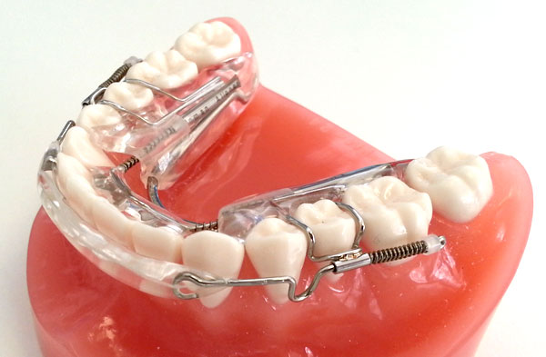 How An Inman Aligner Can Help