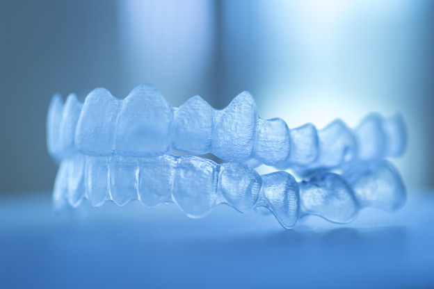 Teeth Straightening Manchester – Inman Aligner vs Invisalign