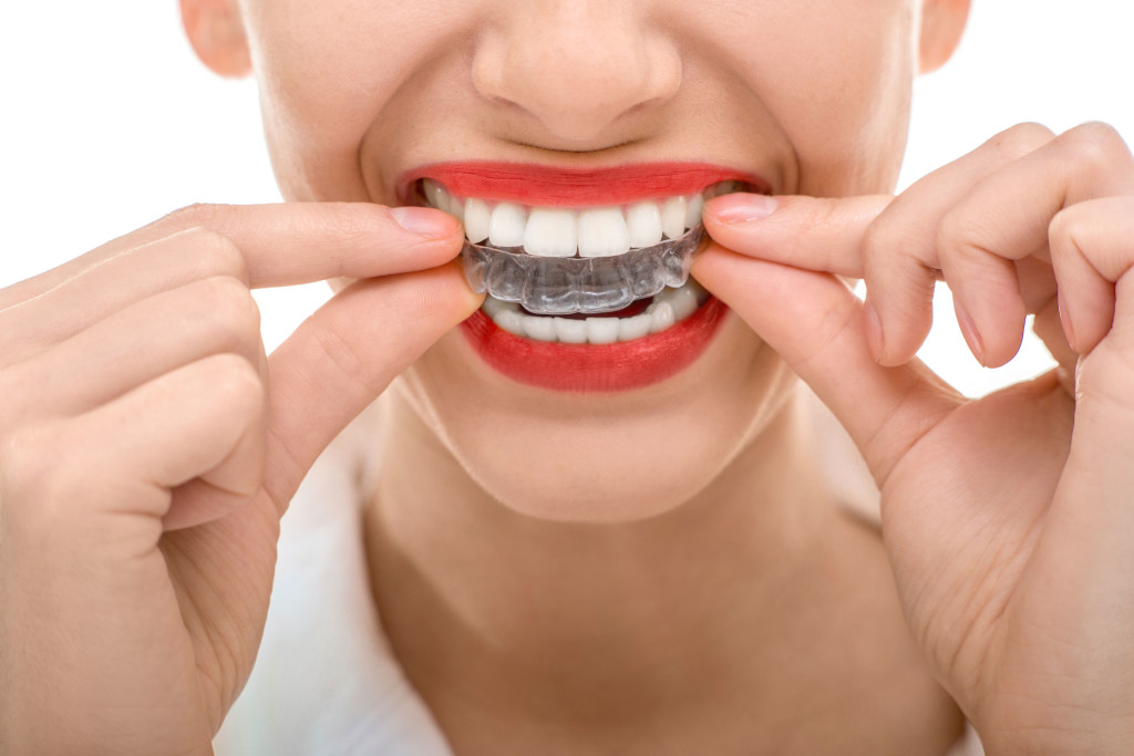 3 Reasons Why You Might Choose Manchester Clear Braces Blog