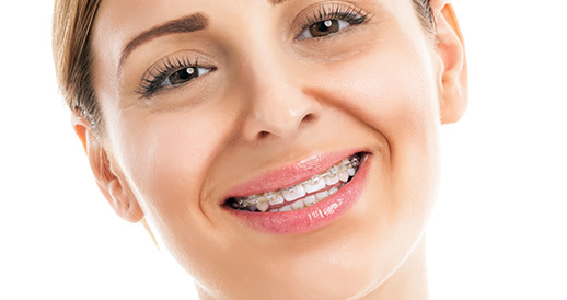 Fast Orthodontic Treatment – What Is It And How Can It Help