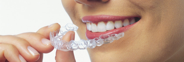 What Invisalign Offers Manchester Patients