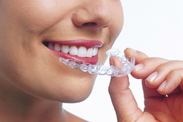 Are Invisalign Braces In Manchester Worth The Cost
