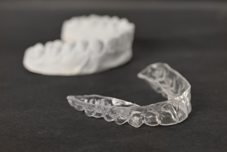 Clear Fixed Braces vs The Inman Aligner – Which Is Best? | Blog