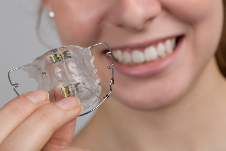 Hulme Orthodontics The Types Of Dental Braces Explained Blog
